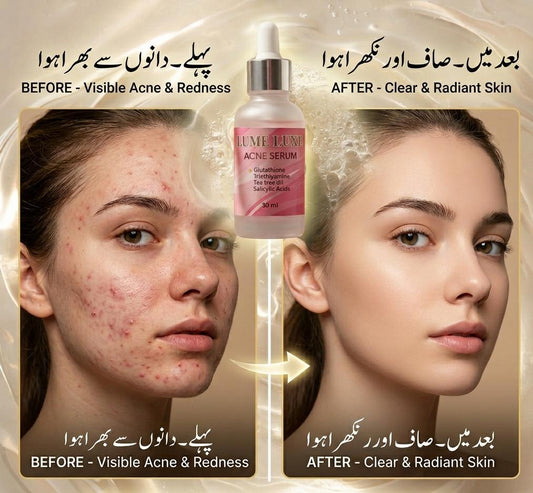 Lume Luxe Acne Control Serum